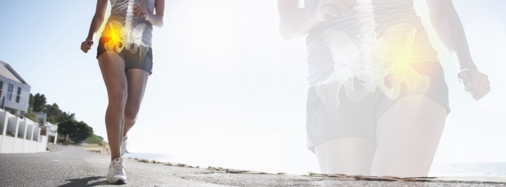 A woman running on the beach with her inflamed hip highlighted in yellow.